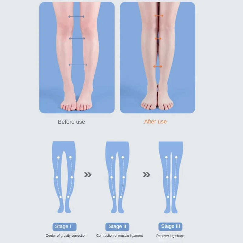 Palmilha ortopédica de suporte de arco de pé chato / Unisex e Corretora de pernas